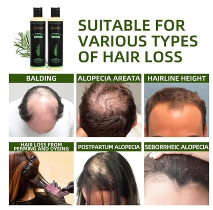 🔥LAST DAY 50% OFF - 🎅Alisanda® Organic Rosemary Hair Growth Shampoo