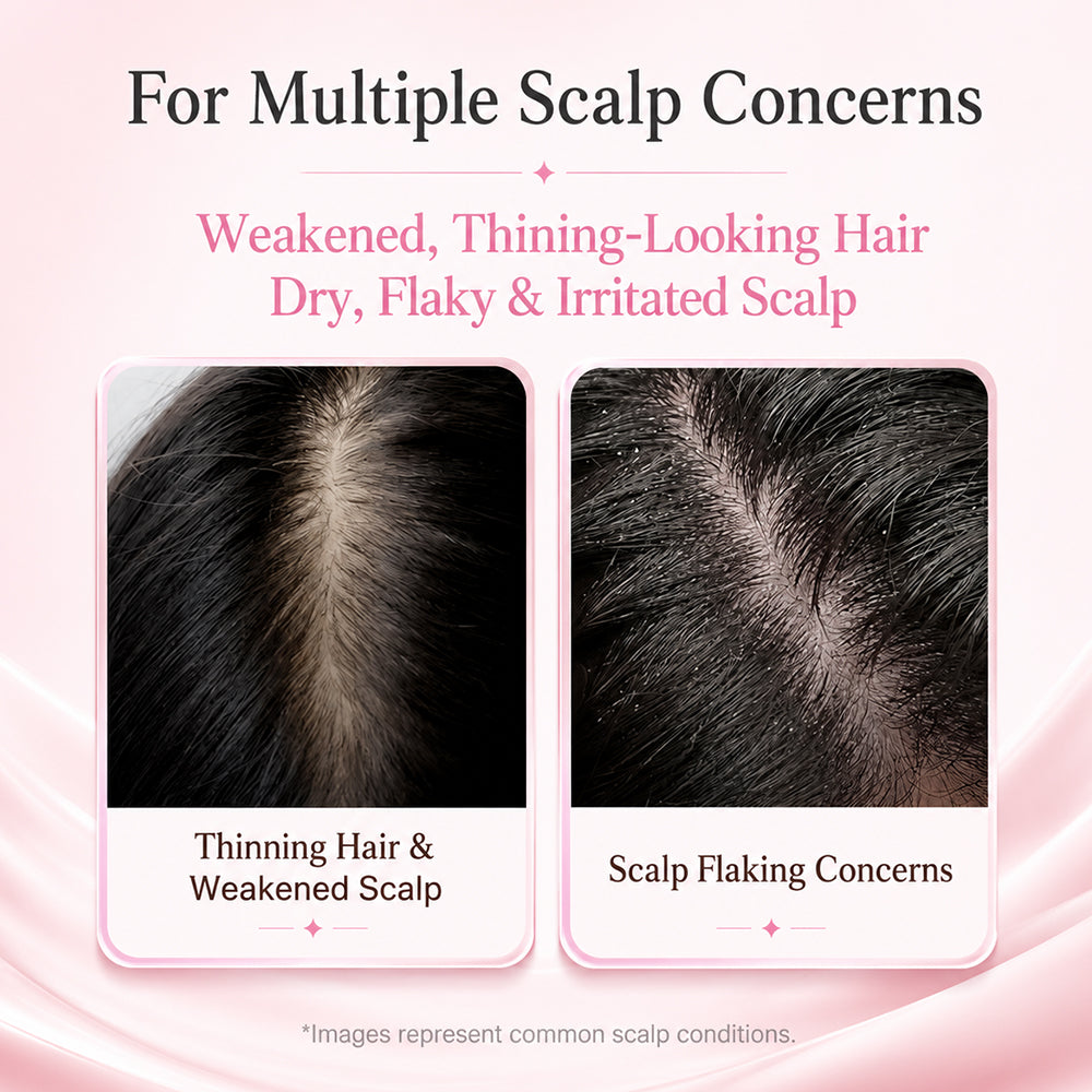 keroynexial  Botanical Scalp Renewal Serum