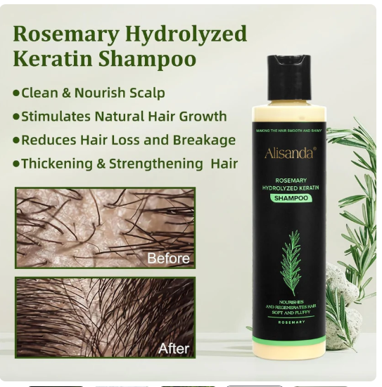 🔥LAST DAY 50% OFF - 🎅Alisanda® Organic Rosemary Hair Growth Shampoo